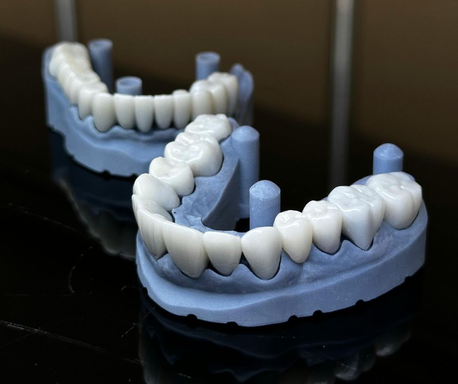 Top 5 Cosmetic Dentistry in Hyderabad